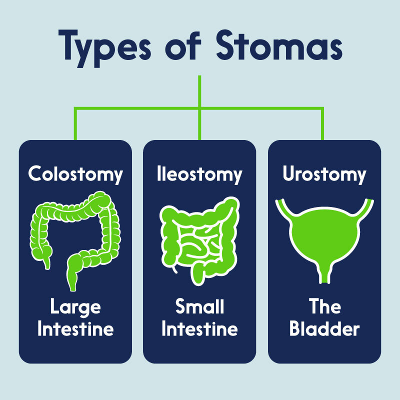 Types of stomas